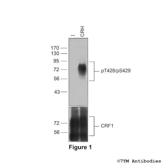 Phospho-Corticotropin-Releasing Factor Receptor 1 (Thr428, Ser429) Antibody in Western Blot (WB)