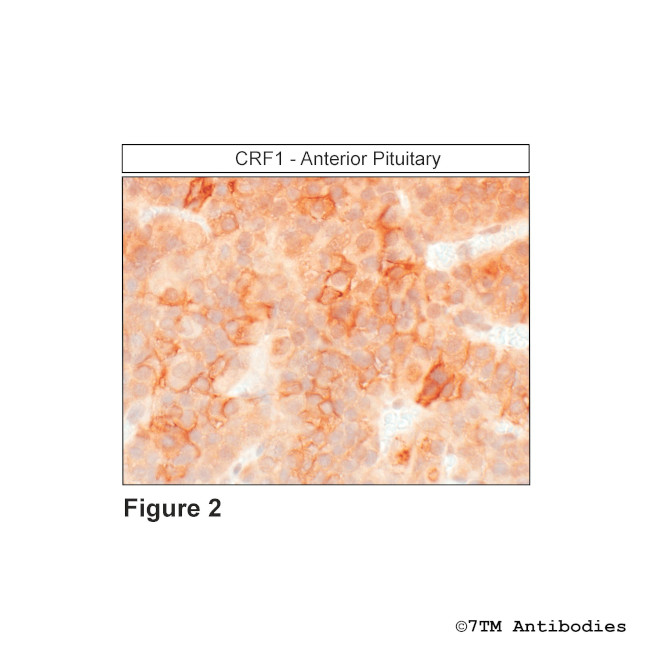 CRF1 (Corticotropin-Releasing Factor Receptor 1) Antibody in Immunohistochemistry (Paraffin) (IHC (P))