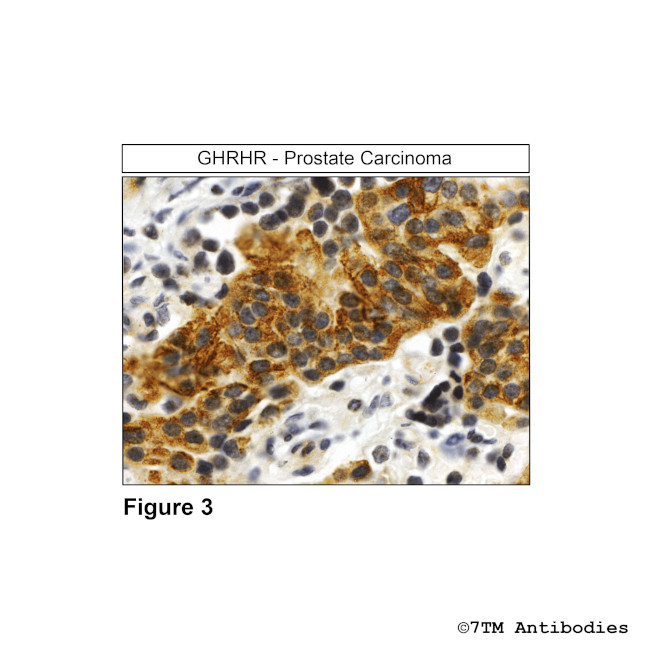 GHRHR, GHRH Receptor Antibody in Immunohistochemistry (Paraffin) (IHC (P))