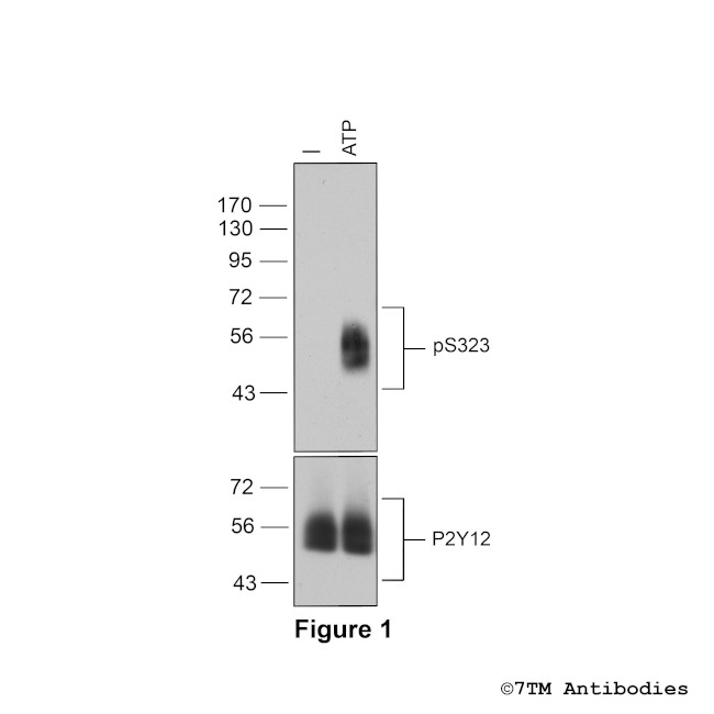 Phospho-P2Y Purinoceptor 12 (Ser323) Antibody in Western Blot (WB)