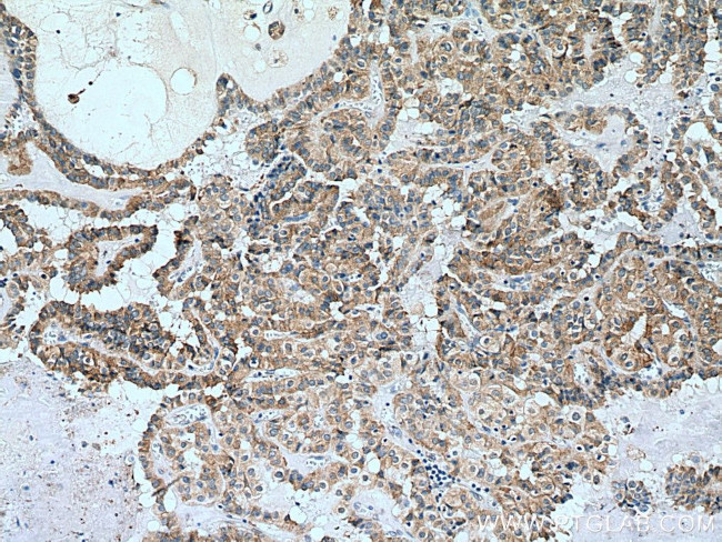 calreticulin Antibody in Immunohistochemistry (Paraffin) (IHC (P))