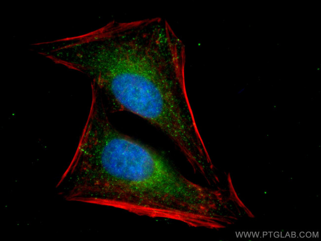 MAP2K3 Antibody in Immunocytochemistry (ICC/IF)