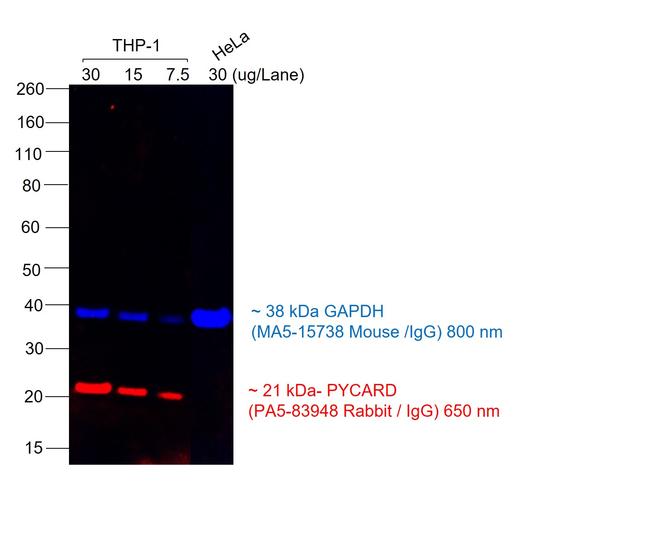 Rabbit IgG (H+L) Secondary Antibody in Western Blot (WB)