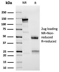 Sarcomeric Actinin Alpha 2/ACTN2 Antibody in SDS-PAGE (SDS-PAGE)