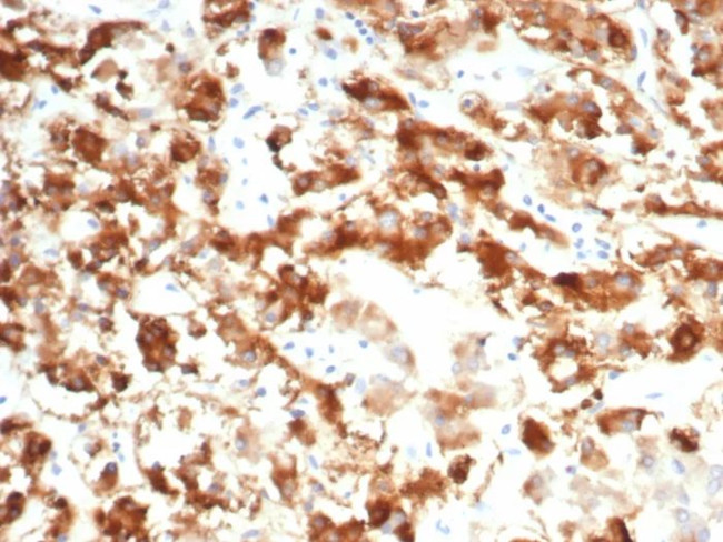 IL18R1 Antibody in Immunohistochemistry (Paraffin) (IHC (P))