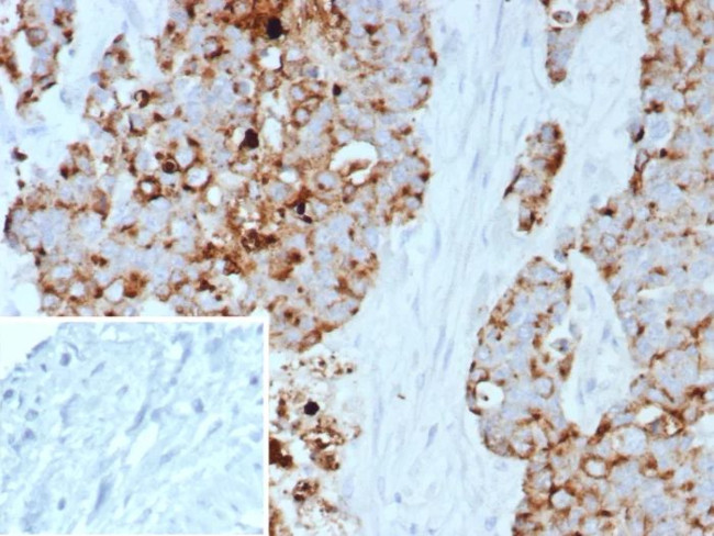 GPRC5A/PEIG-1/RAI3/RAIG1/TIG1 Antibody in Immunohistochemistry (Paraffin) (IHC (P))