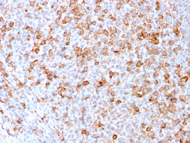 Cd3e T Cell Marker Recombinant Monoclonal Antibody C3e 3171r 916