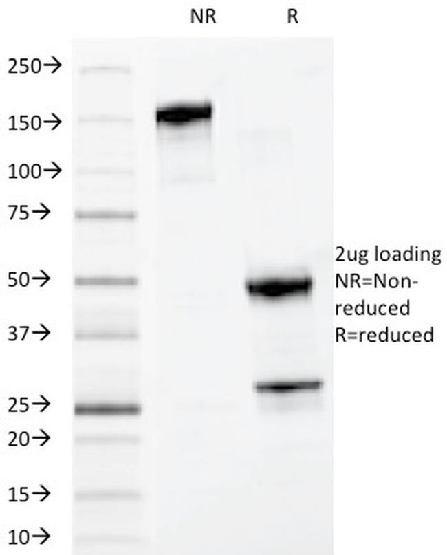 Myeloid-Associated Differentiation Marker (MYADM) Antibody in SDS-PAGE (SDS-PAGE)