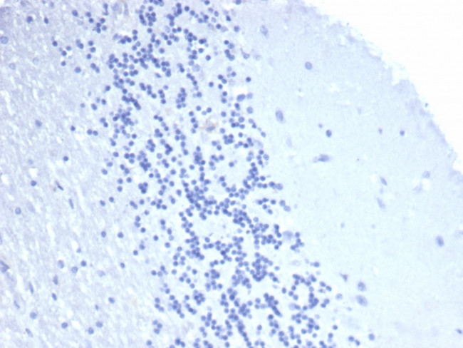 CD4 Antibody in Immunohistochemistry (Paraffin) (IHC (P))