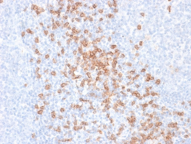 CD8A (Cytotoxic- and Suppressor T-Cell Marker) Antibody in Immunohistochemistry (Paraffin) (IHC (P))