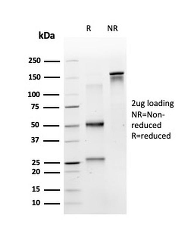 RPS6KA5/MSK1 Antibody in SDS-PAGE (SDS-PAGE)