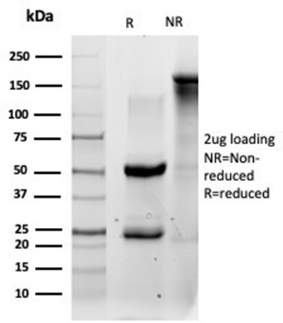 QKI/Protein Quaking Antibody in SDS-PAGE (SDS-PAGE)