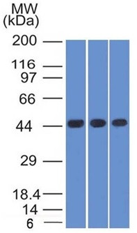 Napsin A (Lung Adenocarcinoma Marker) Antibody in Western Blot (WB)