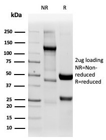 Napsin A (Lung Adenocarcinoma Marker) Antibody in SDS-PAGE (SDS-PAGE)
