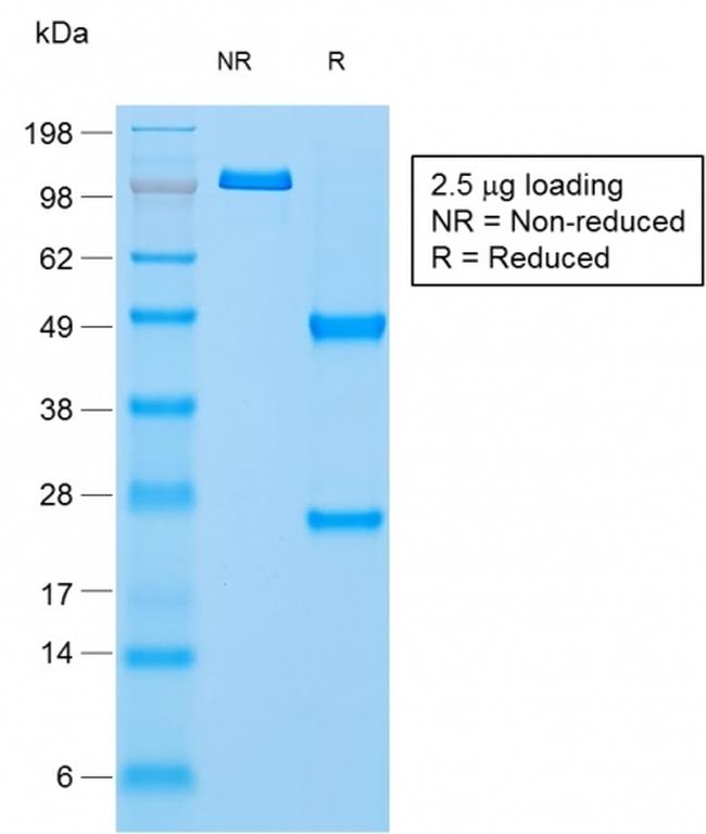 Napsin A Antibody in SDS-PAGE (SDS-PAGE)
