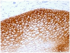 CD44v4 (Marker of Tumor Metastasis) Antibody in Immunohistochemistry (Paraffin) (IHC (P))