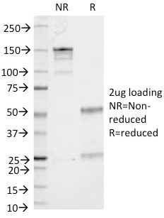 CD53 (TSPAN25) Antibody in SDS-PAGE (SDS-PAGE)