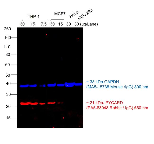 Rabbit IgG (H+L) Cross-Adsorbed Secondary Antibody in Western Blot (WB)