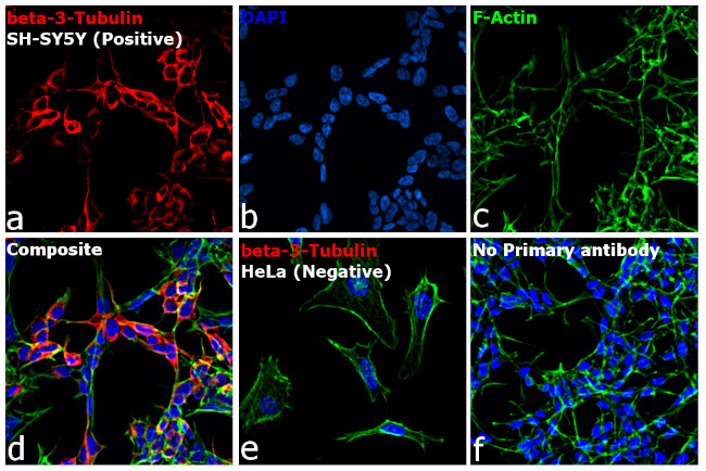 Mouse IgG2a Cross-Adsorbed Secondary Antibody in Immunocytochemistry (ICC/IF)