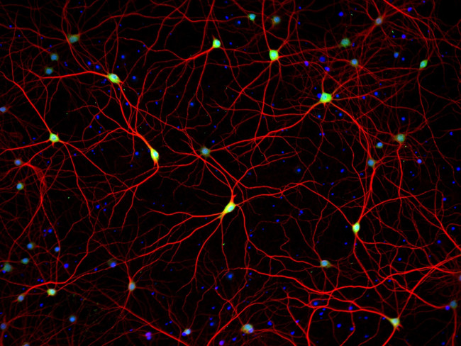 Rabbit IgG (H+L) Highly Cross-Adsorbed Secondary Antibody in Immunocytochemistry (ICC/IF)