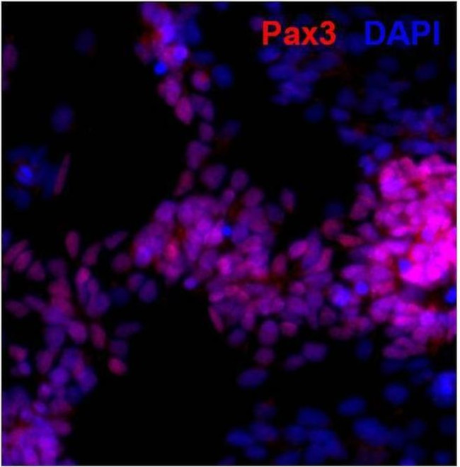 Rabbit IgG (H+L) Highly Cross-Adsorbed Secondary Antibody in Immunocytochemistry (ICC/IF)