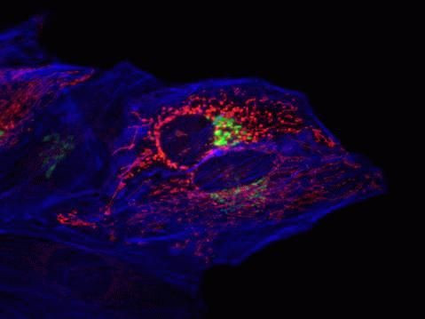 Rabbit IgG (H+L) Highly Cross-Adsorbed Secondary Antibody in Immunocytochemistry (ICC/IF)