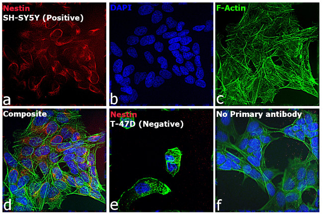 Mouse IgG (H+L) Highly Cross-Adsorbed Secondary Antibody in Immunocytochemistry (ICC/IF)