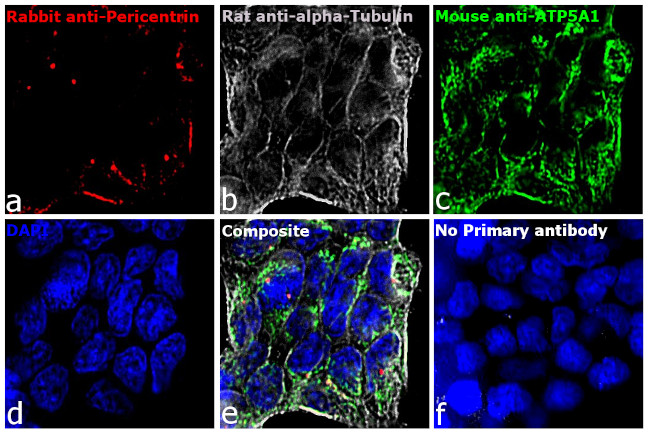 Mouse IgG (H+L) Cross-Adsorbed Secondary Antibody in Immunocytochemistry (ICC/IF)