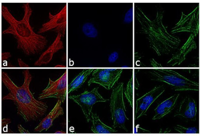 Mouse IgG (H+L) Highly Cross-Adsorbed Secondary Antibody in Immunocytochemistry (ICC/IF)