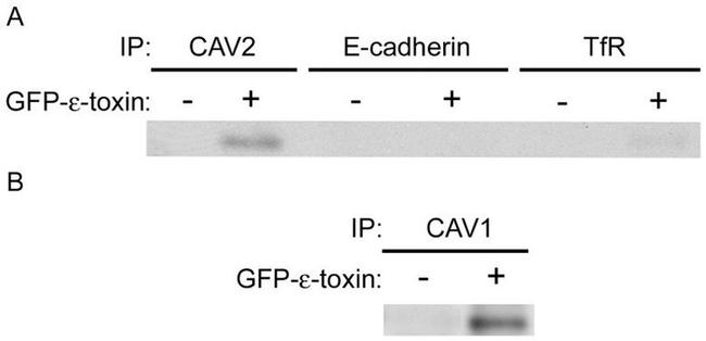 Transferrin Receptor Antibody in Western Blot, Immunoprecipitation (WB, IP)