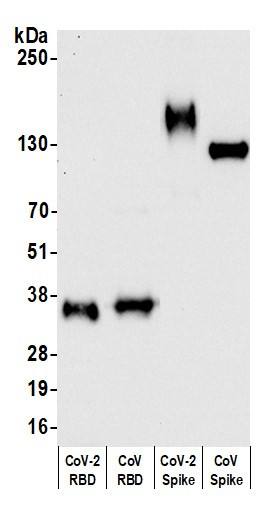 SARS-CoV-2 Spike RBD Antibody in Western Blot (WB)