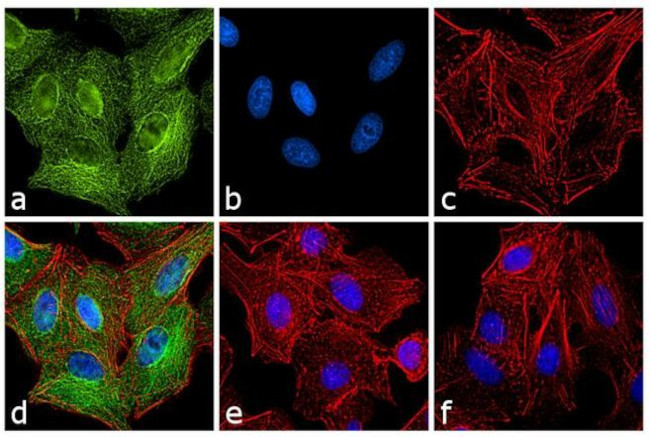 Rat IgG (H+L) Secondary Antibody in Immunocytochemistry (ICC/IF)