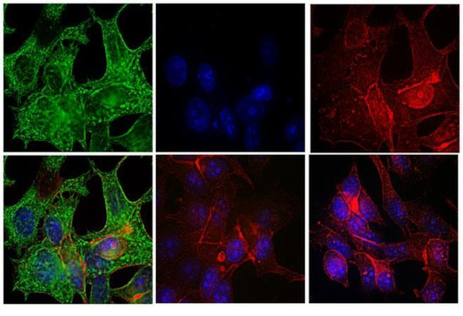 Mouse IgG (H+L) Highly Cross-Adsorbed Secondary Antibody in Immunocytochemistry (ICC/IF)