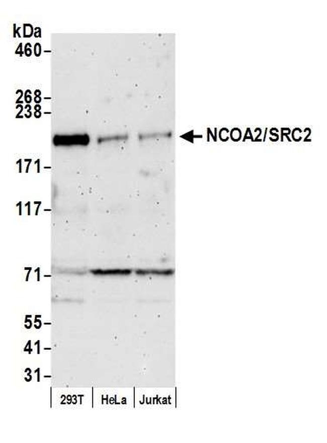 Ncoa2src2 Polyclonal Antibody A300 025a 0448