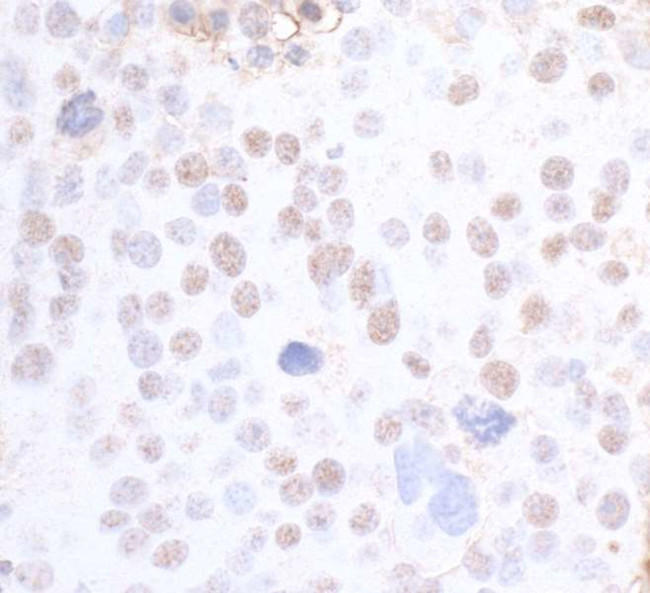 SMC3 Antibody in Immunohistochemistry (Paraffin) (IHC (P))