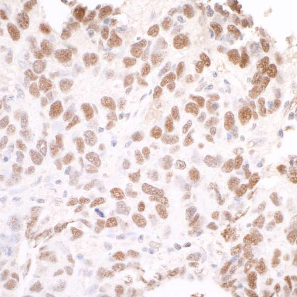 SMC3 Antibody in Immunohistochemistry (Paraffin) (IHC (P))