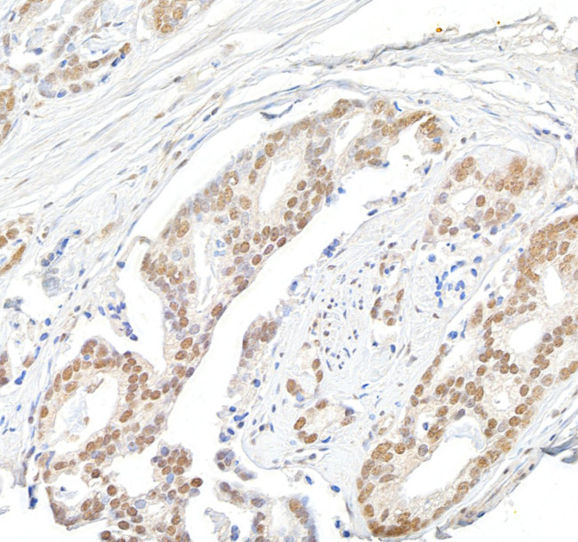 Menin Antibody in Immunohistochemistry (Paraffin) (IHC (P))