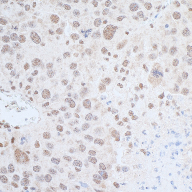 Leo1 Antibody in Immunohistochemistry (Paraffin) (IHC (P))