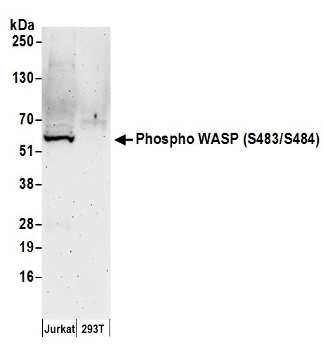 Phospho-WASP (Ser483, Ser484) Antibody in Western Blot (WB)