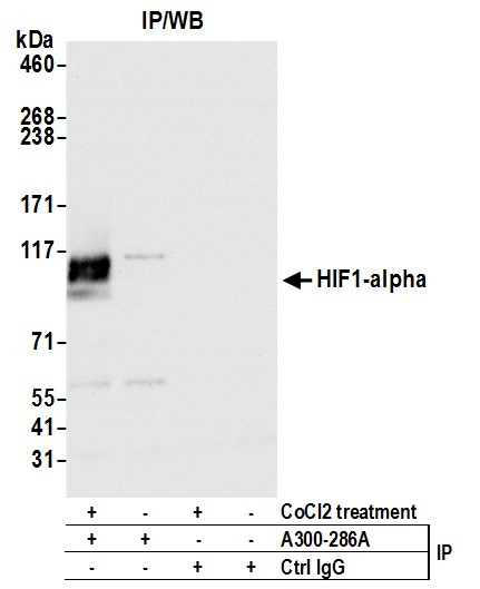 HIF1-alpha Antibody in Immunoprecipitation (IP)
