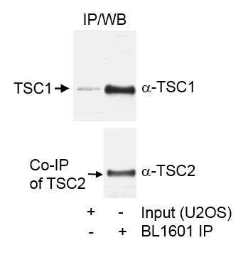 TSC1 Antibody in Immunoprecipitation (IP)