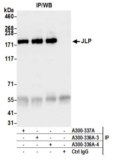 JLP Antibody in Immunoprecipitation (IP)