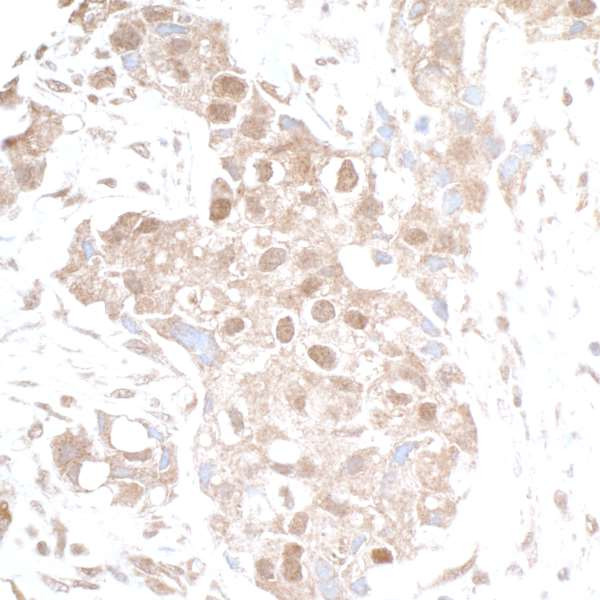 p300 Antibody in Immunohistochemistry (Paraffin) (IHC (P))