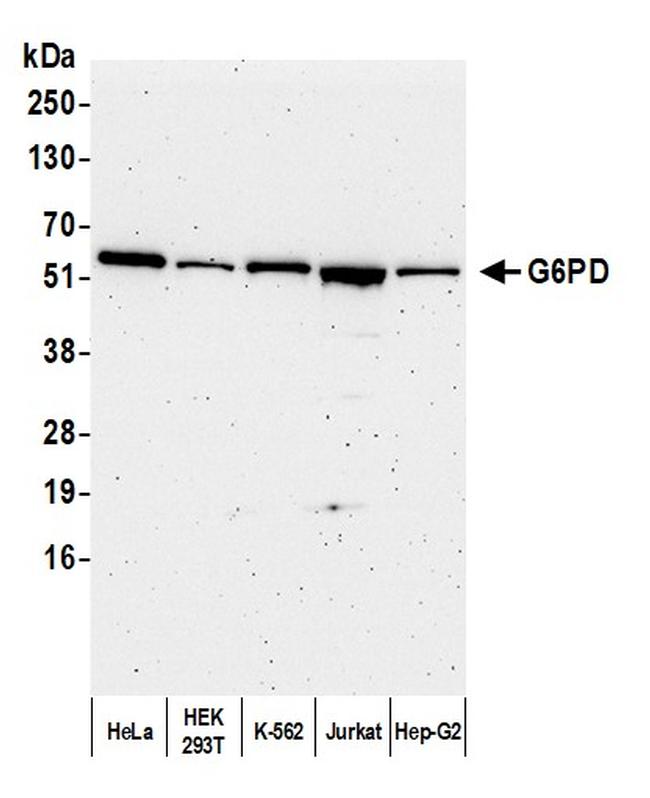 G6PD Antibody in Western Blot (WB)