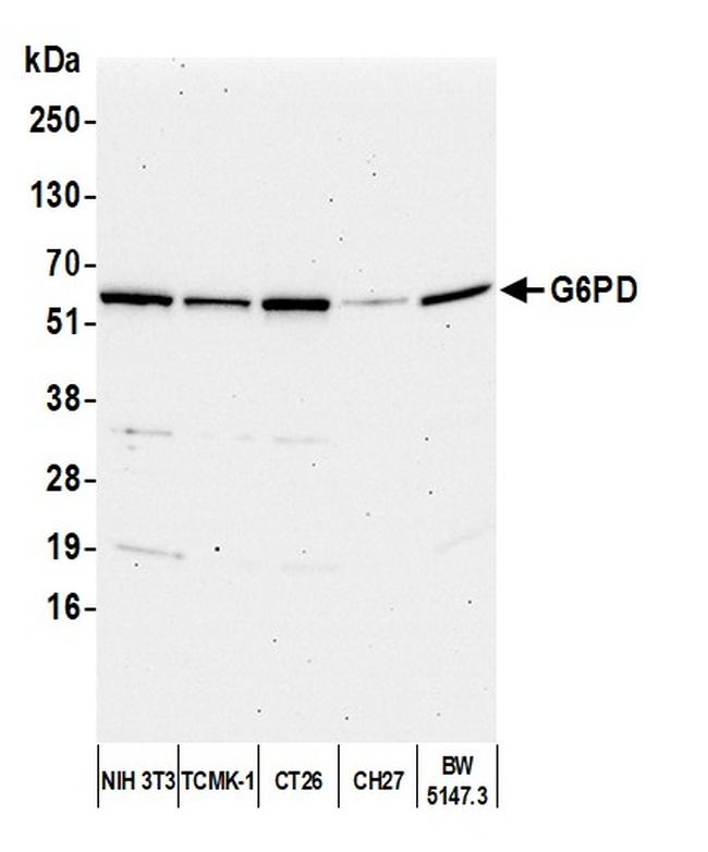 G6PD Antibody in Western Blot (WB)