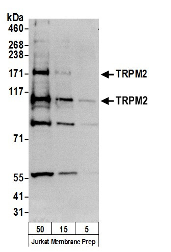 TRPM2 Antibody in Western Blot (WB)