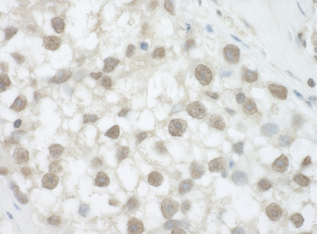 DHX36 Antibody in Immunohistochemistry (Paraffin) (IHC (P))