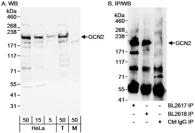 GCN2 Antibody in Western Blot (WB)