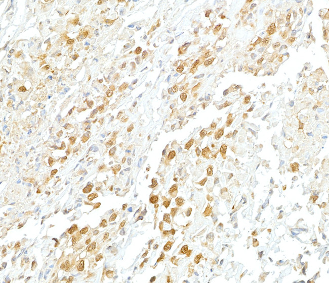 VCP Antibody in Immunohistochemistry (Paraffin) (IHC (P))