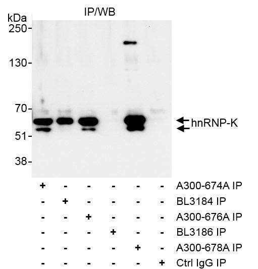hnRNP-K Antibody in Immunoprecipitation (IP)